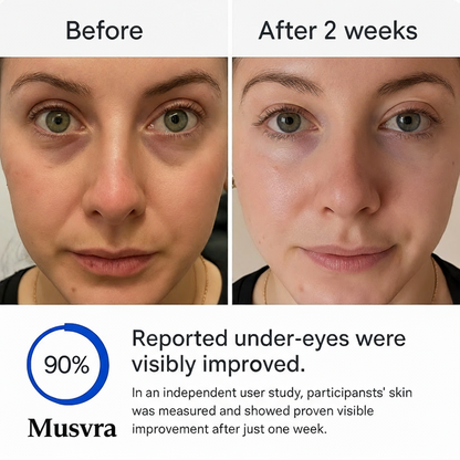 Micro-Infusion Targeted Patches